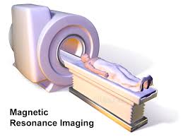 MRI Scan